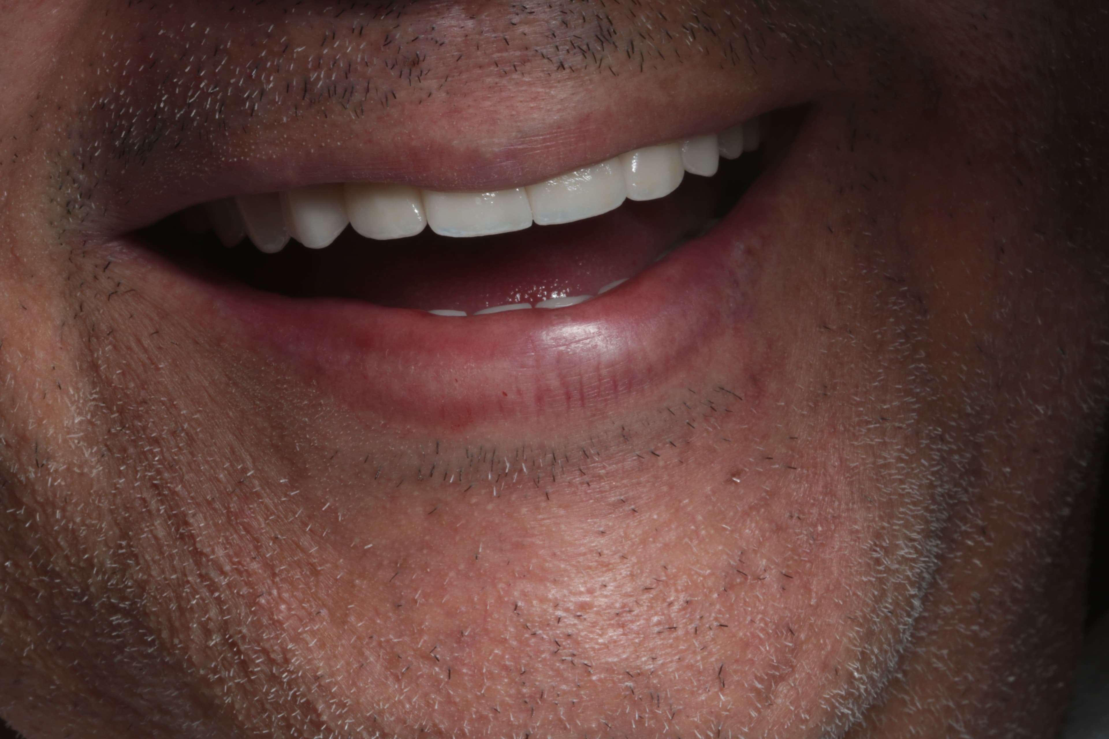 Caso 1 — foto 23