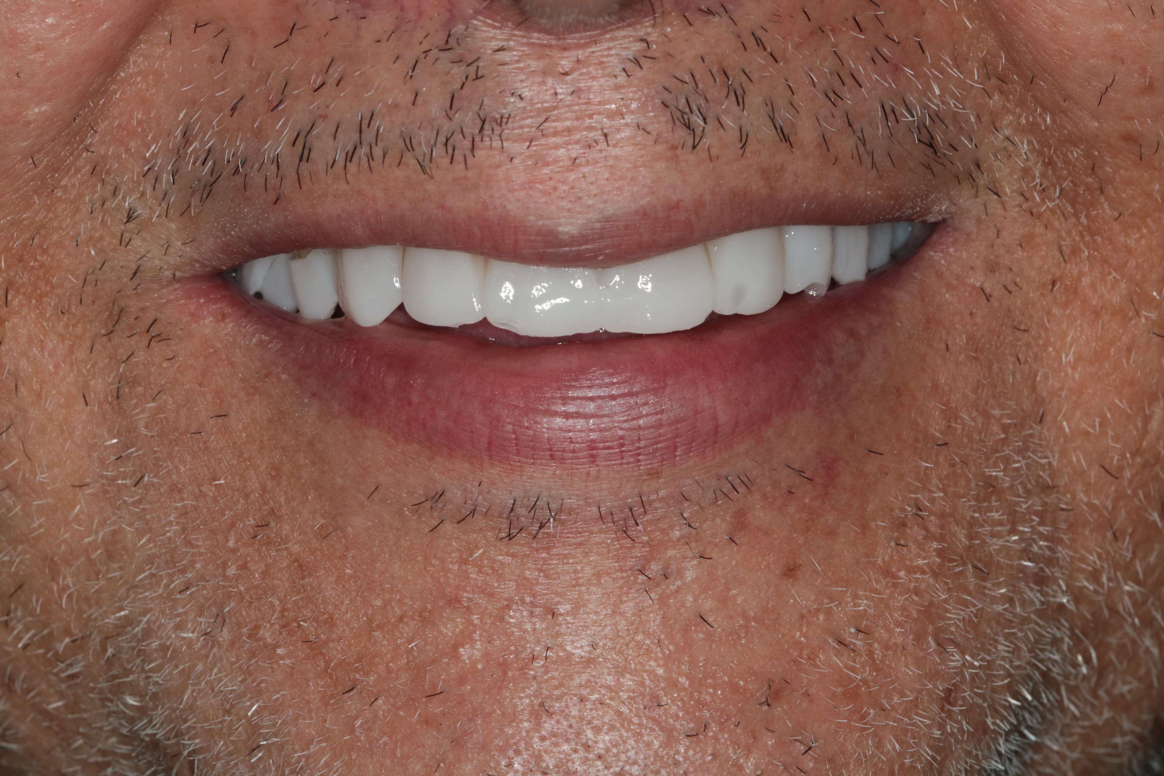 Caso 1 — foto 6