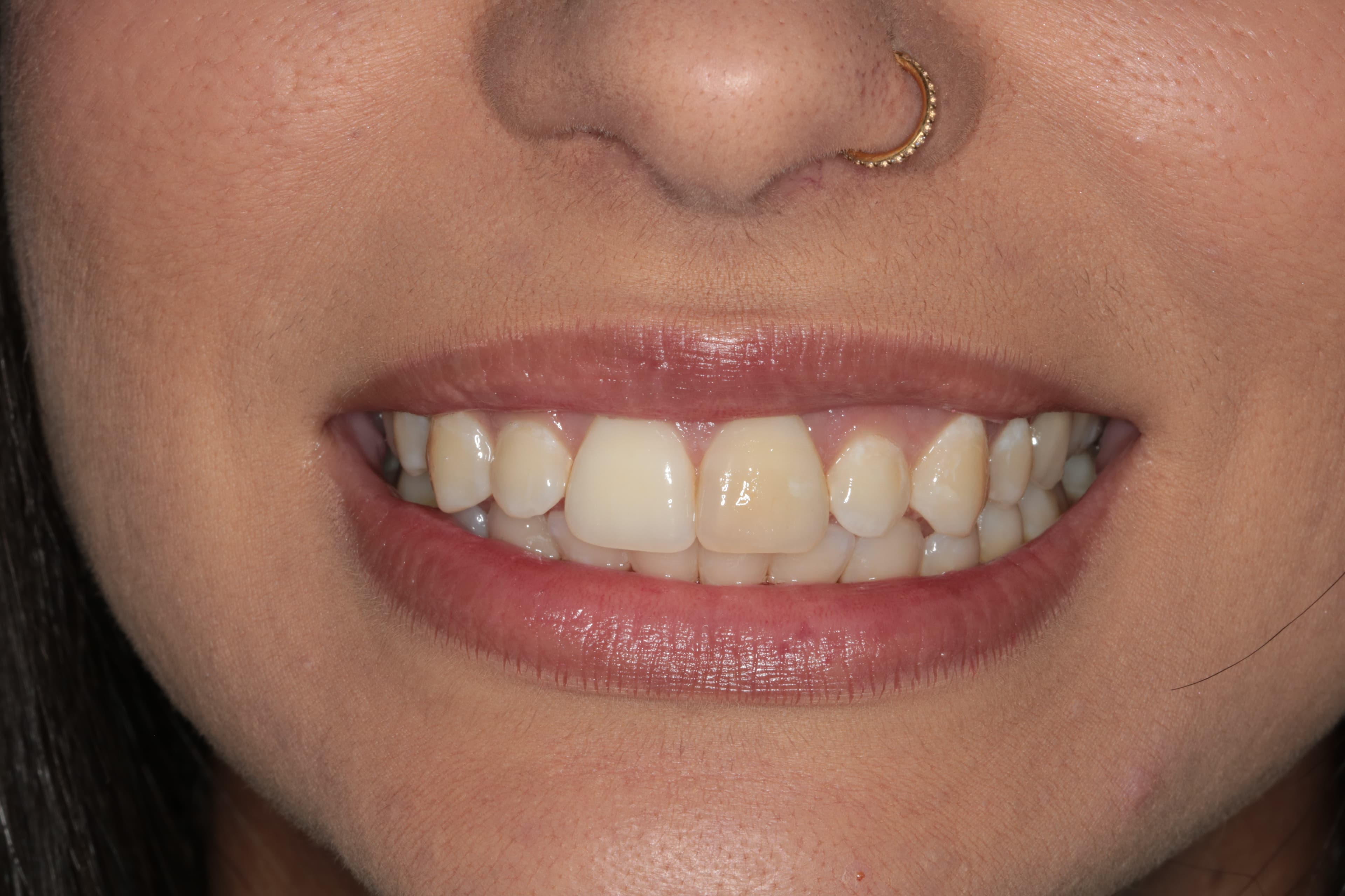 Caso 4 — foto 1
