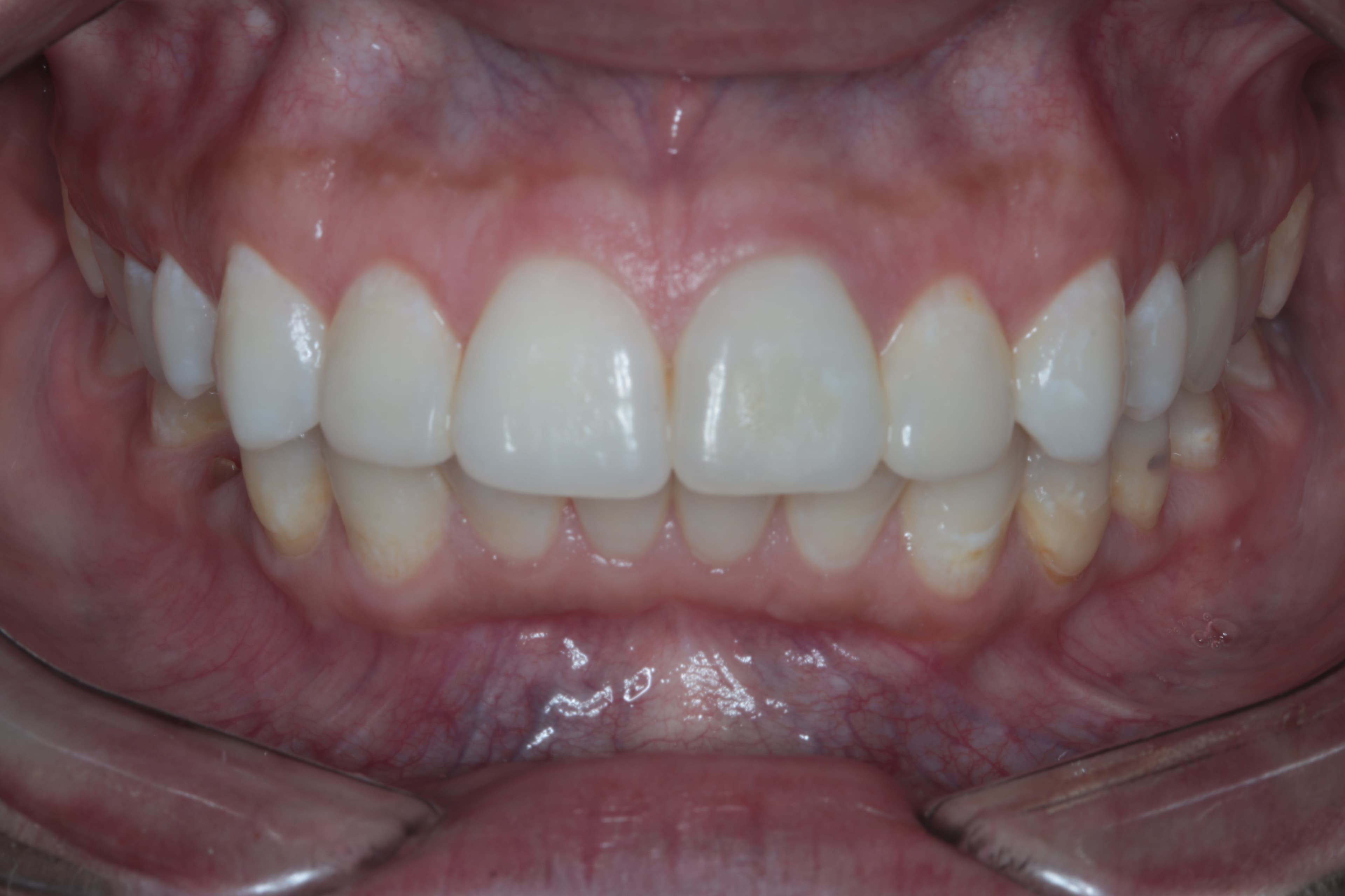 Caso 4 — foto 15