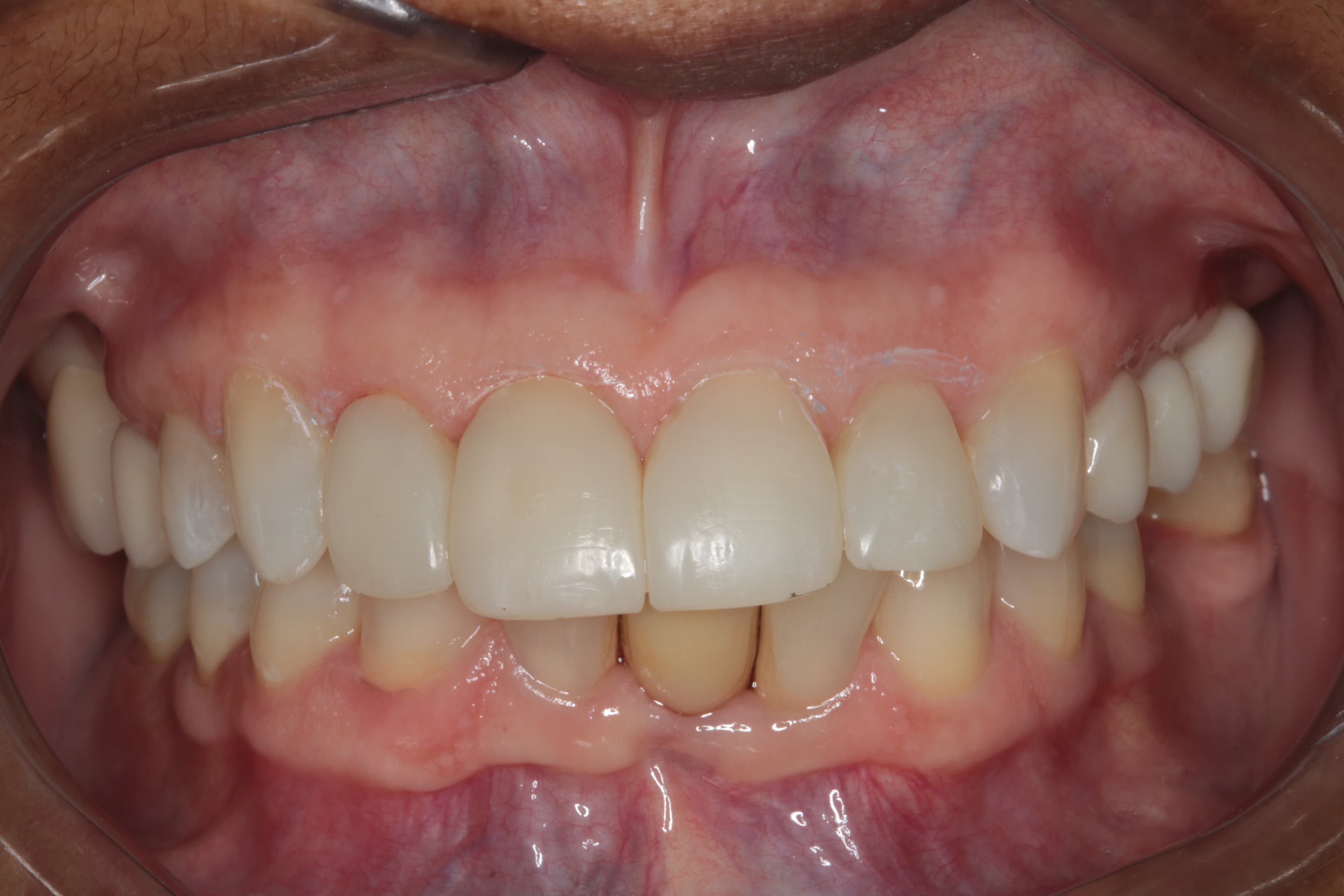 Caso 5 — foto 12