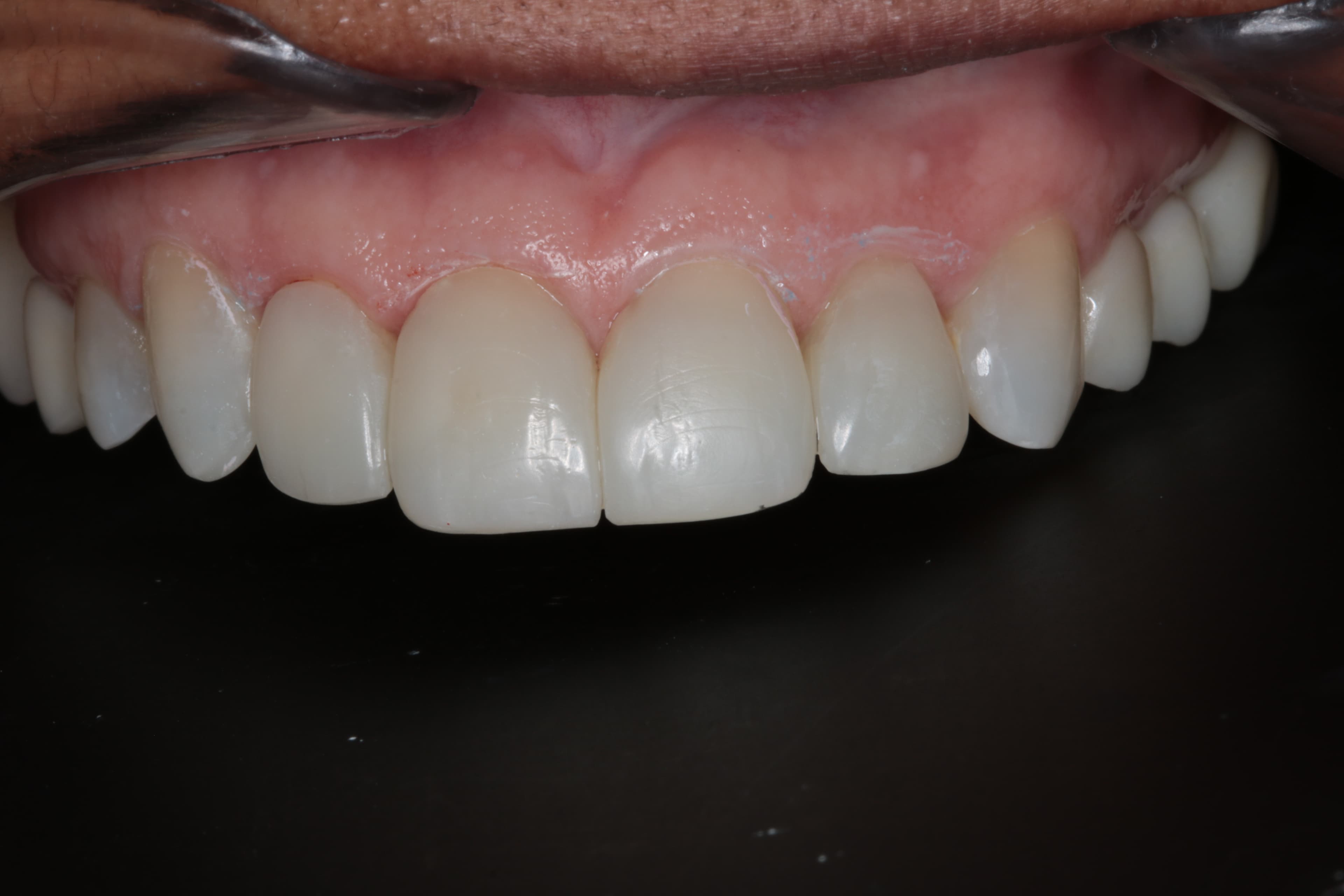 Caso 5 — foto 13