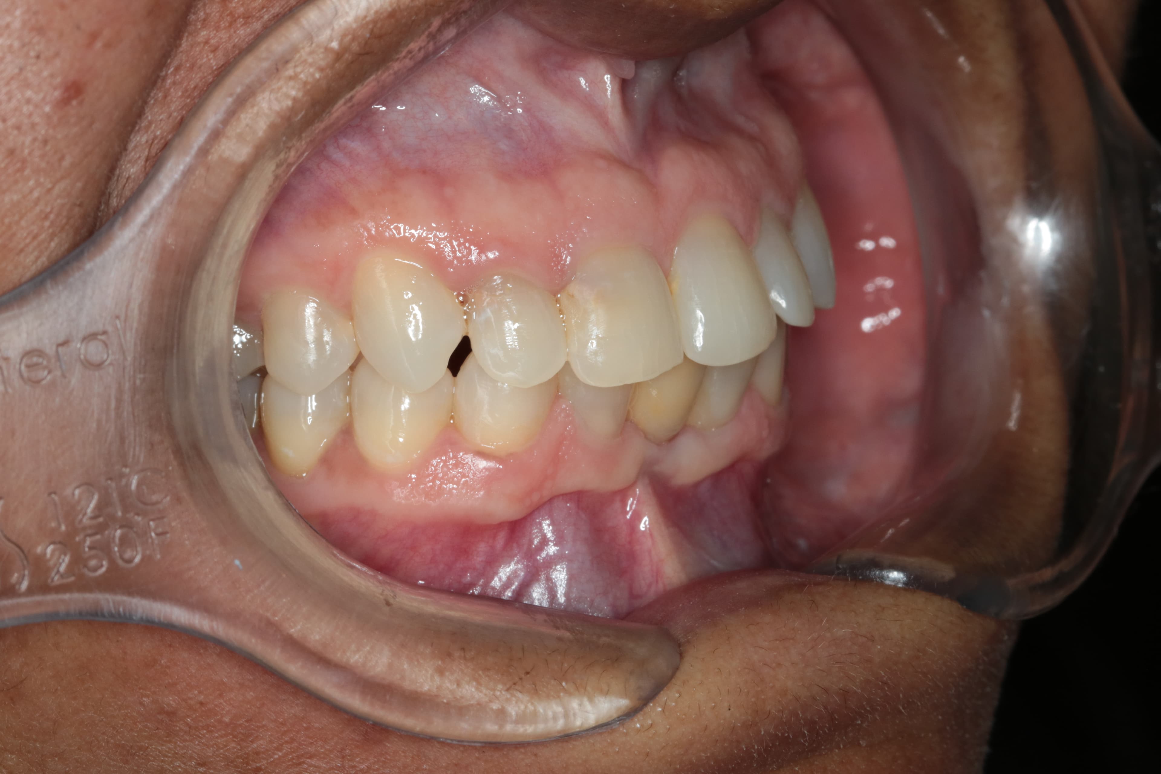 Caso 5 — foto 7