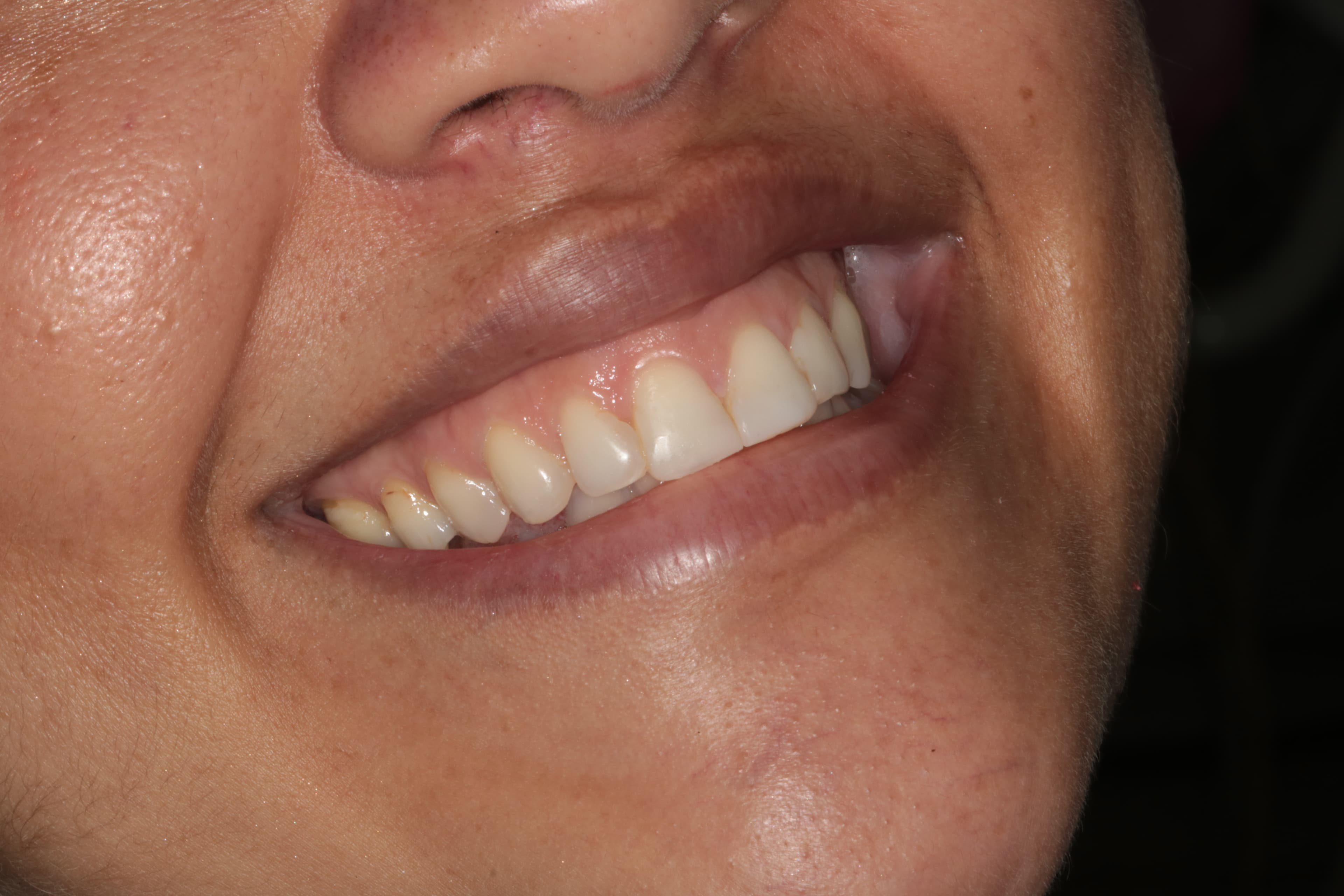 Caso 6 — foto 2