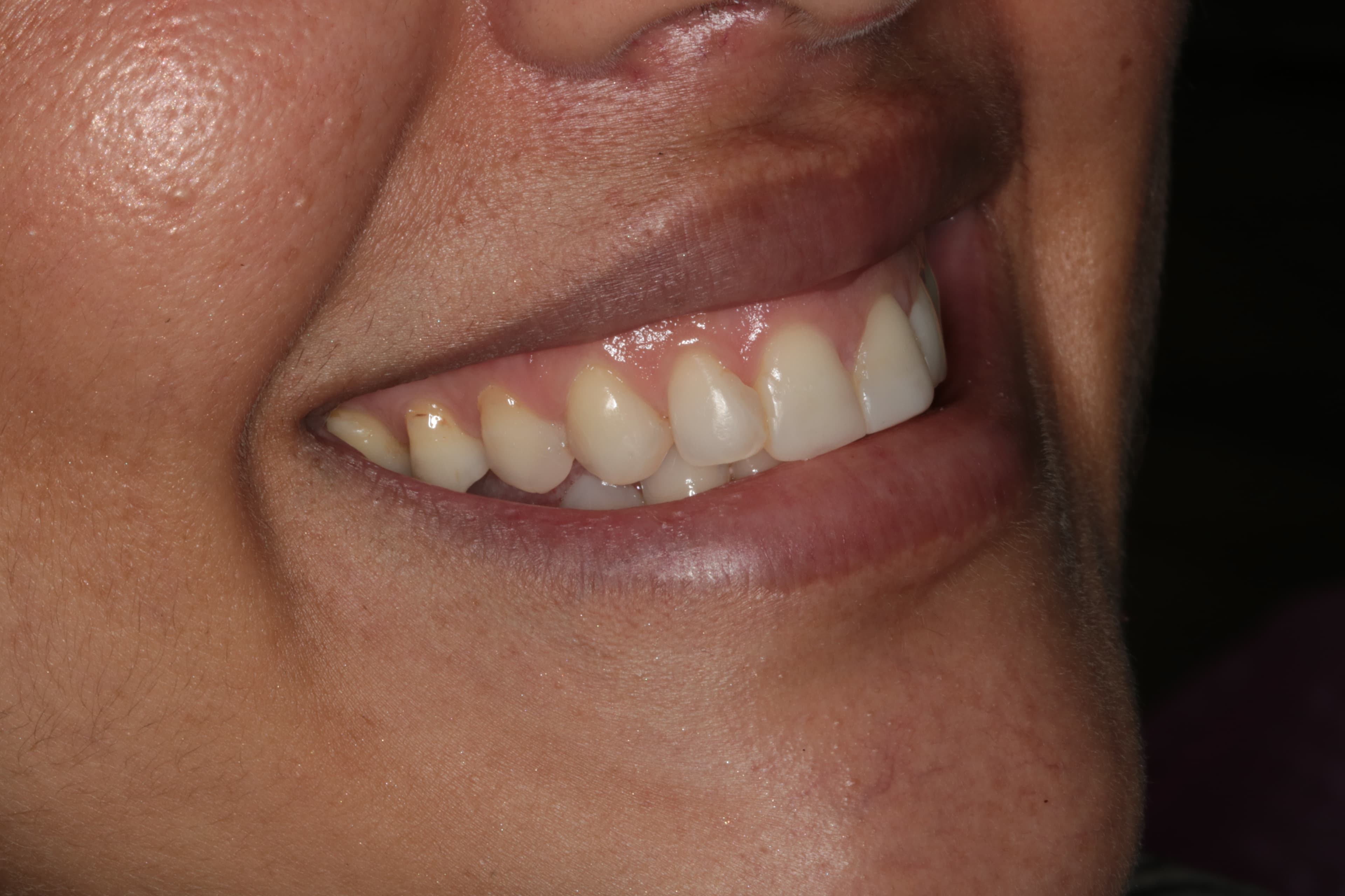 Caso 6 — foto 3