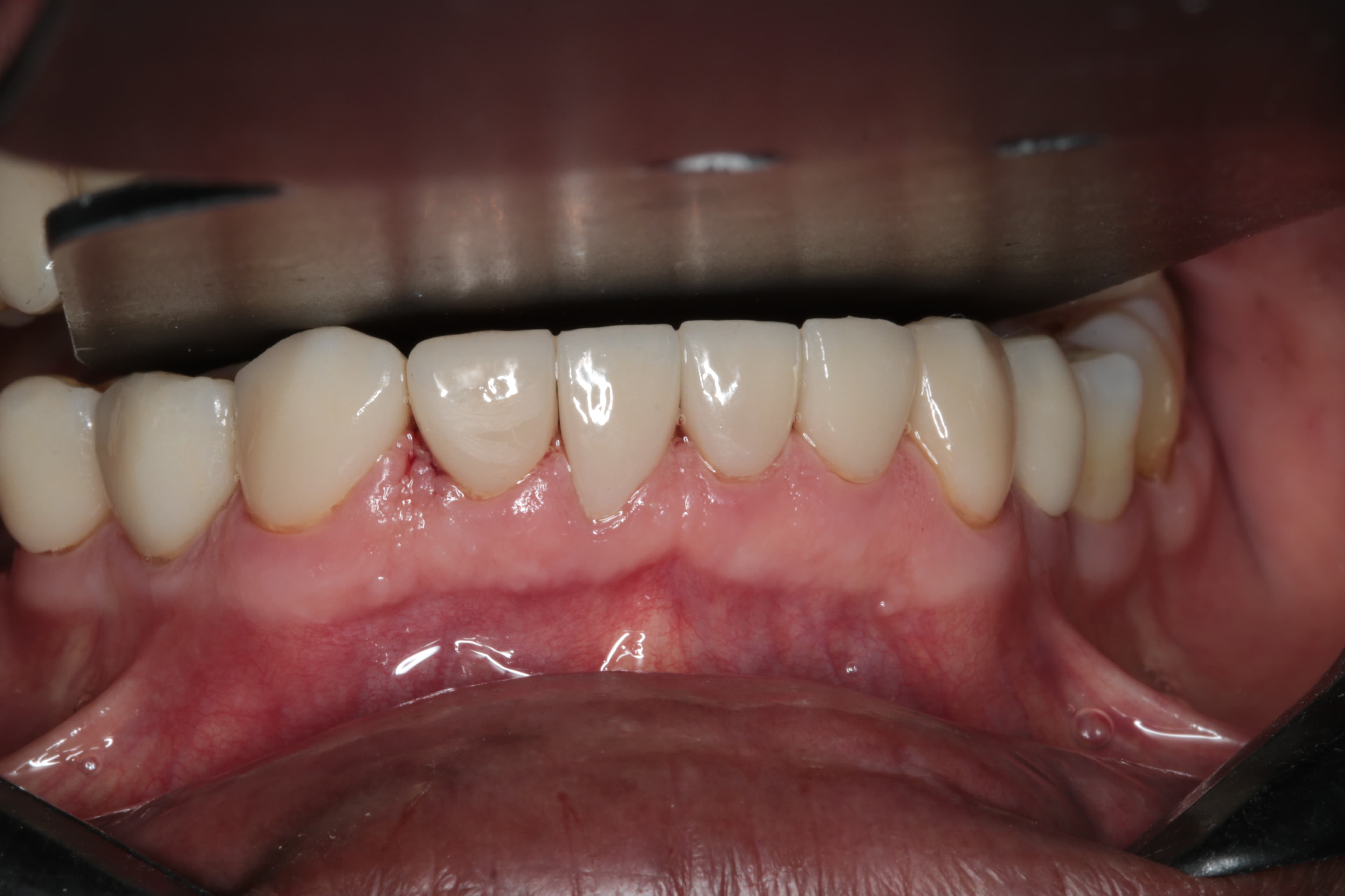 Caso 7 — foto 20
